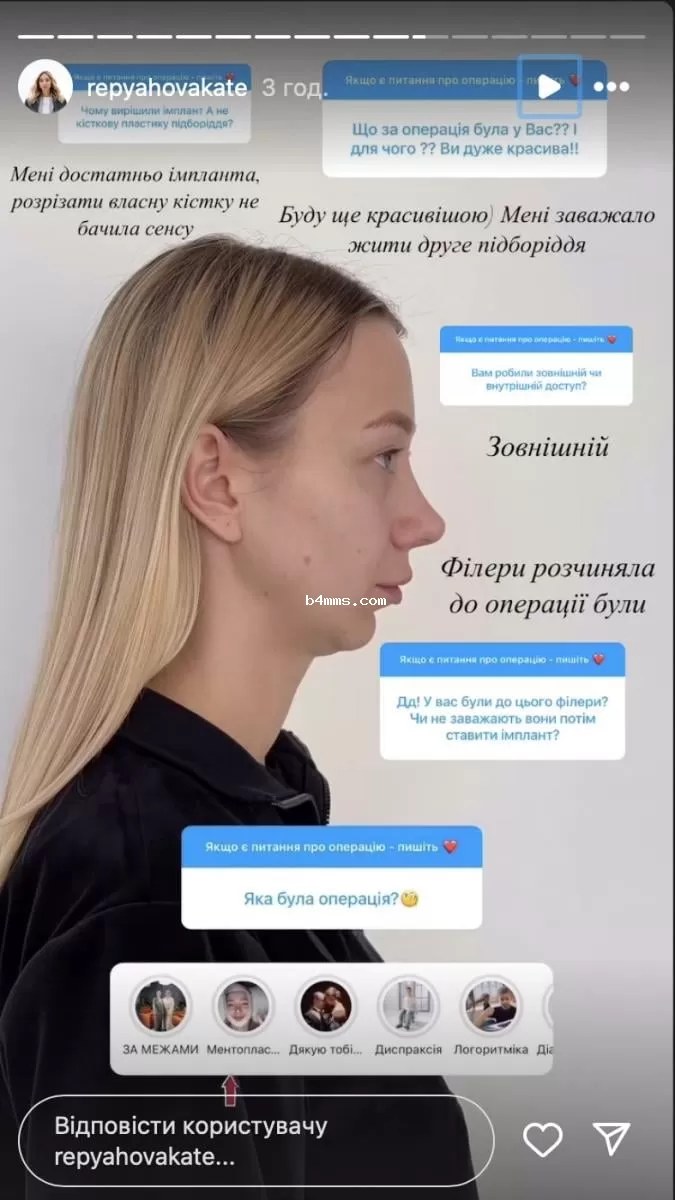 Катерина Репяхова после операции