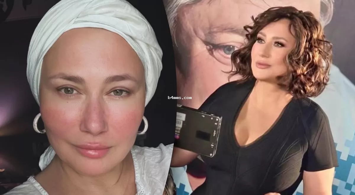 "Каждый день это борьба": Алена Мозговая тронула признанием о тяжелой болезни