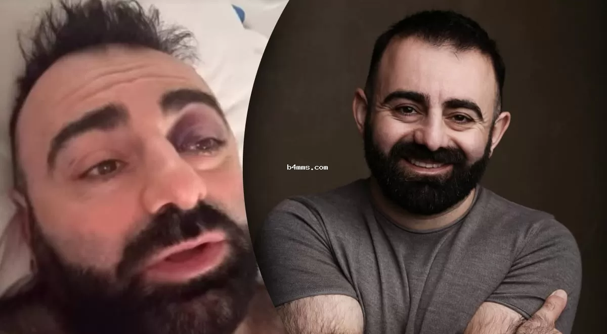 Актер из "Скаженого весілля" попал в больницу с черепной травмой