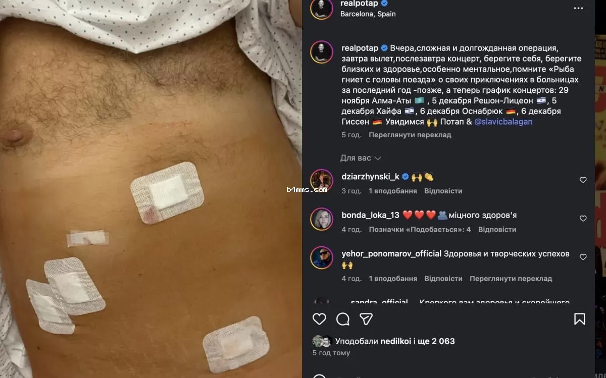 Потап сообщил об операции Потап сообщил об операции