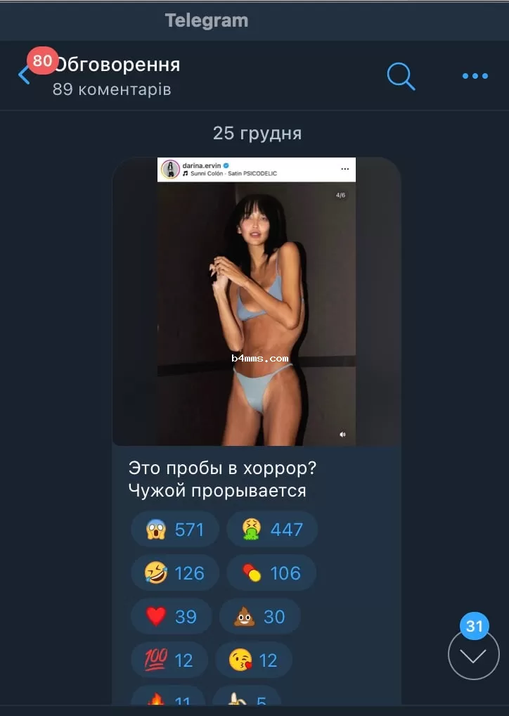 Эрвин ошеломила худобой 