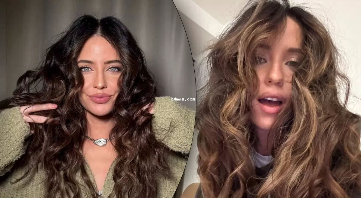 "Больно на это смотреть": Дорофеева напугала синяками на теле